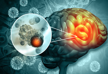 Brain And Spine Tumour Surgery In Thane