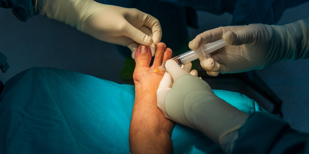 Peripheral Nerve Best Treatment In Thane West